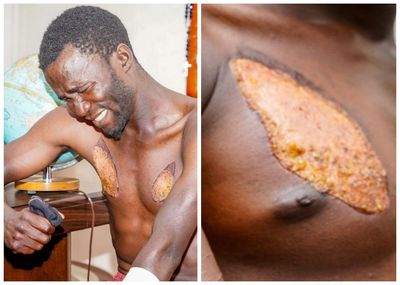 Human rights violations: Mwesigwa's ordeal opens dark new chapter of torture by Uganda's security forces