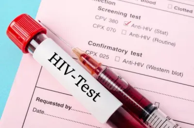 Kampala Registers Over 200 HIV Cases Weekly