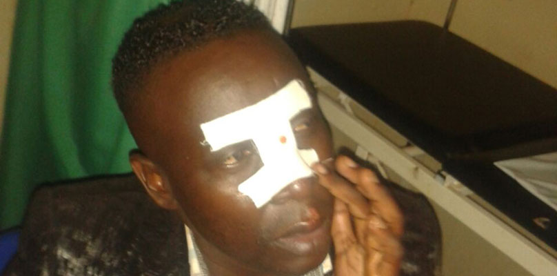 Ssekyewa with injuries after the fall