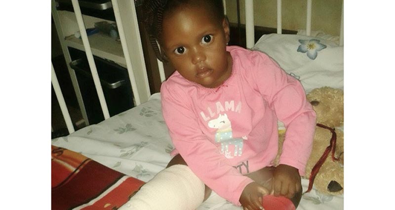 Lyton Nabukeera while at Mulago hospital after sustaining burns on her leg