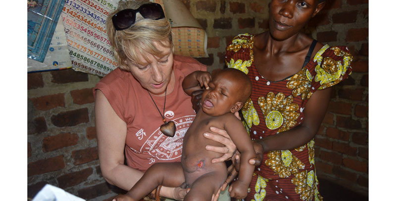 Deborah mckenzie checking out the anal deformed child at their home in Bulele village Buikwe district