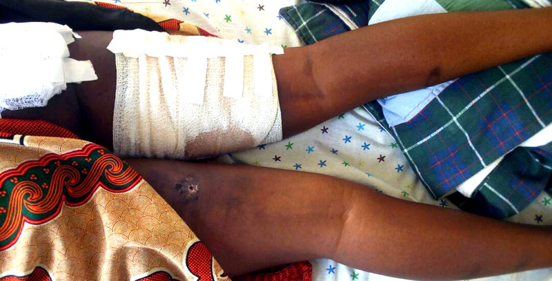 Savanna Namome lies in pain in Mbale General Hospital